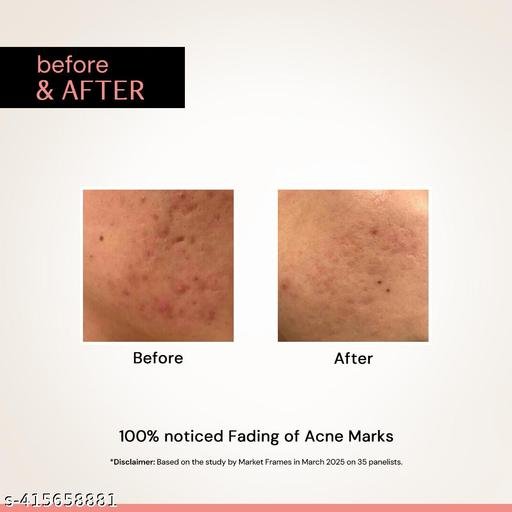 Dark Spot Removal Face Serum for Pimple Marks & Clear Skin | For Dark Spot Corrections and Brighter Complexion | 10ml - Image 4